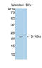 Actin Related Protein 2/3 Complex Subunit 4 antibody, LS-C292607, Lifespan Biosciences, Western Blot image 