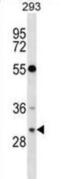 RASD Family Member 2 antibody, abx028744, Abbexa, Western Blot image 