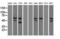 Checkpoint Kinase 2 antibody, LS-C784212, Lifespan Biosciences, Western Blot image 