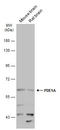 Phosphodiesterase 1A antibody, GTX111687, GeneTex, Western Blot image 