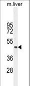 Transmembrane Protein 229A antibody, LS-C203707, Lifespan Biosciences, Western Blot image 