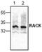 Receptor For Activated C Kinase 1 antibody, GTX59854, GeneTex, Western Blot image 