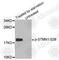 Stathmin 1 antibody, AP0221, ABclonal Technology, Western Blot image 