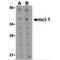 MCL1 Apoptosis Regulator, BCL2 Family Member antibody, MBS151323, MyBioSource, Western Blot image 