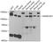SWI/SNF-Related, Matrix-Associated Actin-Dependent Regulator Of Chromatin, Subfamily A, Containing DEAD/H Box 1 antibody, A06049, Boster Biological Technology, Western Blot image 