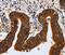 Keratin 23 antibody, PA5-50198, Invitrogen Antibodies, Immunohistochemistry frozen image 