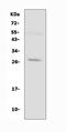 Aquaporin 8 antibody, PA1511, Boster Biological Technology, Western Blot image 