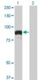 DNA Topoisomerase III Beta antibody, H00008940-M04, Novus Biologicals, Western Blot image 