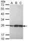 Peroxiredoxin 1 antibody, GTX113793, GeneTex, Western Blot image 