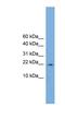 Peptidylprolyl Isomerase Like 3 antibody, NBP1-53189, Novus Biologicals, Western Blot image 