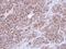 Actinin Alpha 1 antibody, PA5-27870, Invitrogen Antibodies, Immunohistochemistry paraffin image 