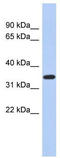 Krueppel-like factor 6 antibody, TA339059, Origene, Western Blot image 