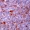 Histone Deacetylase 2 antibody, PA5-32444, Invitrogen Antibodies, Immunohistochemistry paraffin image 