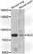 GLI Family Zinc Finger 2 antibody, A6510, ABclonal Technology, Western Blot image 