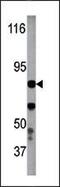 Inhibitor Of Nuclear Factor Kappa B Kinase Subunit Beta antibody, PA5-12608, Invitrogen Antibodies, Western Blot image 