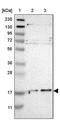 Ubiquitin-conjugating enzyme E2 G2 antibody, PA5-51896, Invitrogen Antibodies, Western Blot image 