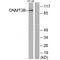 DNA (cytosine-5)-methyltransferase 3B antibody, A00319, Boster Biological Technology, Western Blot image 