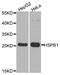 Heat Shock Protein Family B (Small) Member 1 antibody, MBS125283, MyBioSource, Western Blot image 