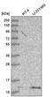 Dynein Light Chain Tctex-Type 1 antibody, HPA046559, Atlas Antibodies, Western Blot image 