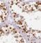 Carnitine Palmitoyltransferase 1C antibody, FNab01945, FineTest, Immunohistochemistry paraffin image 