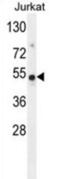 Family With Sequence Similarity 118 Member B antibody, abx026352, Abbexa, Western Blot image 