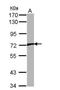 Transient Receptor Potential Cation Channel Subfamily V Member 2 antibody, NBP1-32096, Novus Biologicals, Western Blot image 