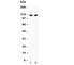 Poly(ADP-Ribose) Polymerase 1 antibody, R31351, NSJ Bioreagents, Western Blot image 