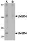 Jumonji Domain Containing 4 antibody, A16245, Boster Biological Technology, Western Blot image 