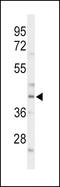 CCAAT Enhancer Binding Protein Alpha antibody, LS-C168648, Lifespan Biosciences, Western Blot image 