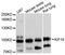 Kinesin Family Member 19 antibody, LS-C748888, Lifespan Biosciences, Western Blot image 