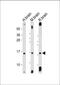 Microtubule Associated Protein 1 Light Chain 3 Alpha antibody, M01543-2, Boster Biological Technology, Western Blot image 