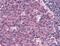 C-C Motif Chemokine Receptor 5 (Gene/Pseudogene) antibody, ab110103, Abcam, Immunohistochemistry paraffin image 