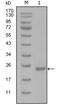 POU Class 5 Homeobox 1 antibody, abx016043, Abbexa, Enzyme Linked Immunosorbent Assay image 