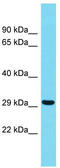 Transcription elongation factor, mitochondrial antibody, TA331737, Origene, Western Blot image 