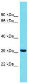 Transcription elongation factor, mitochondrial antibody, TA331737, Origene, Western Blot image 