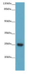 MPT51/MPB51 antigen antibody, A56707-100, Epigentek, Western Blot image 