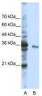 Exosome Component 3 antibody, TA345700, Origene, Western Blot image 