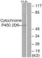 Cytochrome P450 Family 2 Subfamily D Member 6 antibody, LS-C119499, Lifespan Biosciences, Western Blot image 