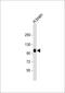 ADAM Metallopeptidase With Thrombospondin Type 1 Motif 17 antibody, 61-287, ProSci, Western Blot image 