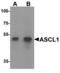 Acsl2 antibody, LS-B8879, Lifespan Biosciences, Western Blot image 