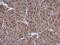 Proteasome 26S Subunit, ATPase 3 antibody, GTX110284, GeneTex, Immunohistochemistry paraffin image 