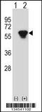 Protein Kinase CAMP-Dependent Type II Regulatory Subunit Beta antibody, 58-130, ProSci, Western Blot image 