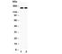 DNA Topoisomerase II Alpha antibody, R30295, NSJ Bioreagents, Western Blot image 