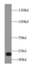 Lysine Acetyltransferase 8 antibody, FNab05266, FineTest, Western Blot image 
