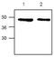 Cellular Communication Network Factor 1 antibody, PA1-23143, Invitrogen Antibodies, Western Blot image 