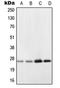 NADH:Ubiquinone Oxidoreductase Core Subunit V2 antibody, LS-C352561, Lifespan Biosciences, Western Blot image 