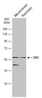 Ornithine Decarboxylase 1 antibody, GTX101521, GeneTex, Western Blot image 