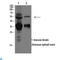 Acid Sensing Ion Channel Subunit 1 antibody, LS-C814228, Lifespan Biosciences, Western Blot image 