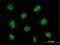 Zinc Finger Protein 624 antibody, H00057547-B01P, Novus Biologicals, Immunofluorescence image 