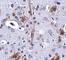 Tau Tubulin Kinase 1 antibody, NBP1-76989, Novus Biologicals, Immunohistochemistry frozen image 